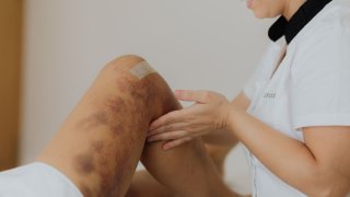 Fisioterapia em Cirurgia Plástica e Reconstrutiva